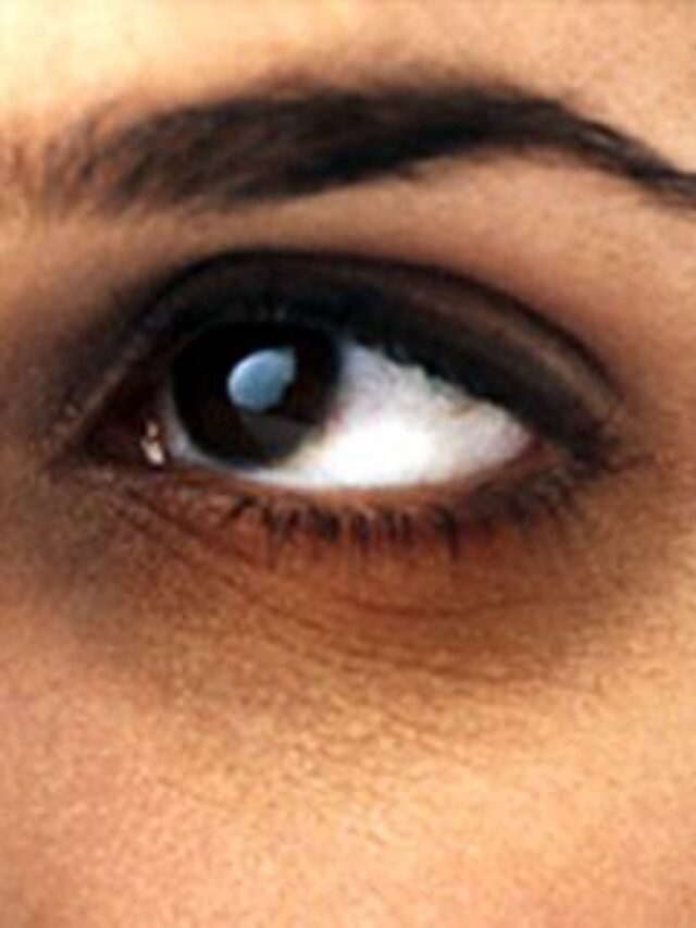 dark circles removal tips